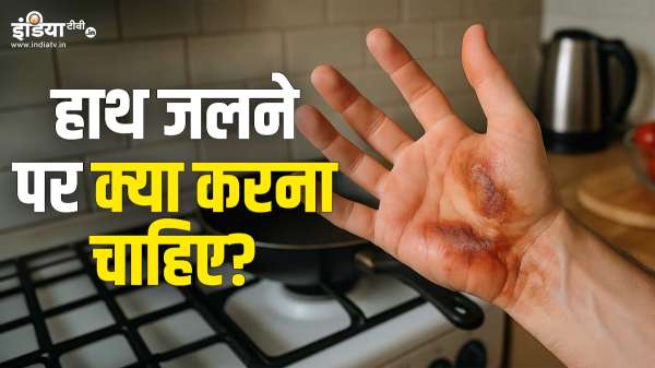 Hands are burnt while working in the kitchen, so these home remedies will immediately relax